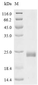 Human Tumor necrosis factor receptor superfamily member 10D (TNFRSF10D), partial Recombinant Protein, N-His-SUMO, Homo sapiens (Human), E.coli, N-terminal 6xHis-SUMO-tagged, 29.8 kDa, purity >≥ 85% as determined by SDS-PAGE.