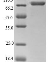 Human Calreticulin (CALR) Recombinant Protein, N-GST - BioCrest Sci