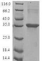 Human Eotaxin (CCL11) Recombinant Protein - BioCrest Sci