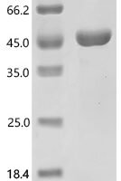 Human Autophagy-related protein 2 homolog A (ATG2A), partial Recombinant Protein, C-His - BioCrest Sci