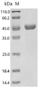Human Autophagy-related protein 2 homolog A (ATG2A), partial Recombinant Protein, C-His, E.coli, C-terminal 6xHis-tagged, 43.6 kDa, purity >≥ 90% as determined by SDS-PAGE.