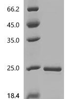 Rat Interferon gamma (Ifng) Recombinant Protein, N-His, aa 23–156, E.coli - BioCrest Sci