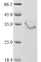 Vaccinia virus Protein OPG190 (OPG190), partial Recombinant Protein, N-10His/C-Myc - BioCrest Sci