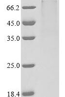 Human Plasminogen (PLG) (T114M) Recombinant Protein - BioCrest Sci