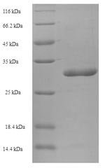 Human Store-operated calcium entry-associated regulatory factor (SARAF), partial Recombinant Protein, Homo sapiens (Human), E.coli, N-terminal 6xHis-SUMO-tagged, 31.5 kDa, purity >≥ 90% as determined by SDS-PAGE.