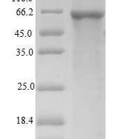 Mouse Putative phospholipase B-like 2 (Plbd2) Recombinant Protein, N-His, aa 47–594, E.coli - BioCrest Sci