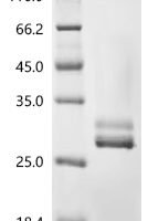 Human Kallikrein-2 (KLK2) Recombinant Protein, N-His - BioCrest Sci