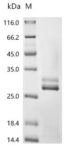 Human Kallikrein-2 (KLK2) Recombinant Protein, N-His, Homo sapiens (Human), Yeast, N-terminal 6xHis-tagged, 28.2 kDa, purity >≥ 95% as determined by SDS-PAGE.