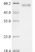 Bovine Beta-arrestin-2 (ARRB2) Recombinant Protein - BioCrest Sci