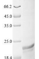 Staphylococcus aureus Immunodominant staphylococcal antigen B (isaB) Recombinant Protein, N-10His/C-Myc - BioCrest Sci