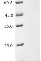 Mycobacterium tuberculosis Serine/threonine-protein kinase pknF (pknF) Recombinant Protein - BioCrest Sci