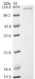 Mycobacterium tuberculosis Serine/threonine-protein kinase pknF (pknF) Recombinant Protein, Mycobacterium tuberculosis (strain CDC 1551 / Oshkosh), E.coli, N-terminal GST-tagged, 78.1 kDa, purity >≥ 85% as determined by SDS-PAGE.