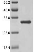 Human GTPase KRas (KRAS) (G12V), partial Recombinant Protein - BioCrest Sci
