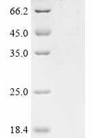 Mopeia virus Pre-glycoprotein polyprotein GP complex (GPC), partial Recombinant Protein - BioCrest Sci