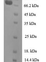Human Cell division cycle protein 23 homolog (CDC23), partial Recombinant Protein - BioCrest Sci