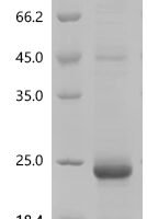 Mouse Growth/differentiation factor 9 (Gdf9) Recombinant Protein, C-His - BioCrest Sci