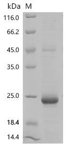 Mouse Growth/differentiation factor 9 (Gdf9) Recombinant Protein, C-His, Mus musculus (Mouse), E.coli, C-terminal 6xHis-tagged, 22.5 kDa, purity >≥ 90% as determined by SDS-PAGE.