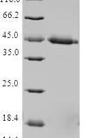 Human Mitochondrial import inner membrane translocase subunit Tim17-A (TIMM17A) Recombinant Protein - BioCrest Sci