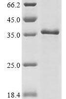Human Cytochrome c1,heme protein, mitochondrial (CYC1) Recombinant Protein - BioCrest Sci