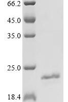 Mycobacterium bovis Immunogenic protein MPB70 (mpb70) Recombinant Protein - BioCrest Sci