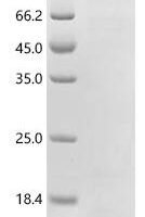 Human Matrix Gla protein (MGP) Recombinant Protein, Tag-Free - BioCrest Sci
