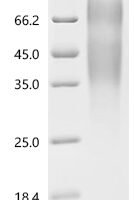 Human Receptor-type tyrosine-protein phosphatase alpha (PTPRA), partial Recombinant Protein - BioCrest Sci