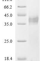 Dog tissue kallikrein (KLK5), partial Recombinant Protein, C-10His - BioCrest Sci