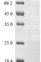 Influenza B virus Nuclear export protein (NS) Recombinant Protein - BioCrest Sci