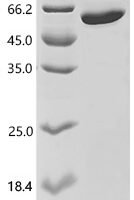 Human ADAMTS-like protein 5 (ADAMTSL5) Recombinant Protein - BioCrest Sci