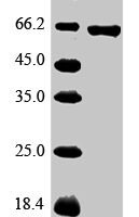 Pan troglodytes Glypican-3 (GPC3) Recombinant Protein - BioCrest Sci