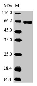 Pan troglodytes Glypican-3 (GPC3) Recombinant Protein, Pan troglodytes (Chimpanzee), Mammalian cell, N-terminal 6xHis-Myc-tagged, 64.9 kDa, purity >≥ 90% as determined by SDS-PAGE.