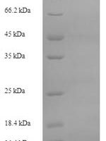 Rat Protein S100-A8 (S100a8) Recombinant Protein - BioCrest Sci