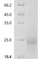 Mouse Granulocyte-macrophage colony-stimulating factor (Csf2) Recombinant Protein, N-10His - BioCrest Sci
