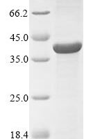 Neisseria meningitidis serogroup B Major outer membrane protein P.IB (porB) Recombinant Protein, N-His, aa 20–331, UniProt P30687 - BioCrest Sci