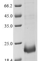 Mouse Killer cell lectin-like receptor subfamily G member 1 (Klrg1), partial Recombinant Protein, N-10His/C-Myc - BioCrest Sci