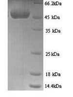Mouse CCN family member 1 (Ccn1) Recombinant Protein, N-His - BioCrest Sci