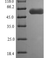 Campylobacter jejuni Flagellin B (flaB) Recombinant Protein, C-His - BioCrest Sci