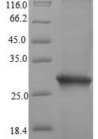 Human Sperm-egg fusion protein Juno (IZUMO1R) Recombinant Protein, N-His, aa 20–250, E.coli - BioCrest Sci