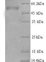 Human AP-2 complex subunit mu (AP2M1) Recombinant Protein, N-His - BioCrest Sci