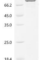 Human Heterogeneous nuclear ribonucleoprotein K (HNRNPK), partial Recombinant Protein, N-His-GST - BioCrest Sci