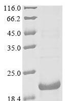 Mouse Gastric inhibitory polypeptide receptor (Gipr), partial Recombinant Protein - BioCrest Sci