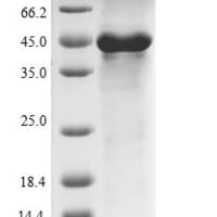 Escherichia coli Heat-labile enterotoxin A chain (eltA) Recombinant Protein, N-His-SUMO/C-Myc - BioCrest Sci