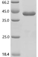 Mouse Protein IL-40 Recombinant Protein, N-His-SUMO - BioCrest Sci
