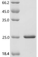 Mouse Midkine (Mdk) Recombinant Protein, C-His - BioCrest Sci