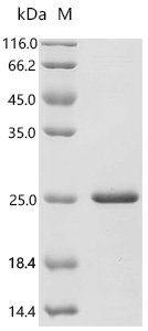 Mouse Midkine (Mdk) Recombinant Protein, C-His, Mus musculus (Mouse), E.coli, C-terminal 6xHis-tagged, 20.0 kDa, purity >≥ 95% as determined by SDS-PAGE.