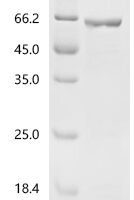Mouse Glial fibrillary acidic protein (Gfap) Recombinant Protein, N-His, aa 1–430, E.coli - BioCrest Sci