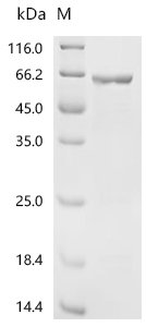 Mouse Glial fibrillary acidic protein (Gfap) Recombinant Protein, N-His, aa 1–430, E.coli, Mus musculus(Mouse), E.coli, N-terminal 6xHis-tagged, 66.4 kDa, purity >≥ 85% as determined by SDS-PAGE.