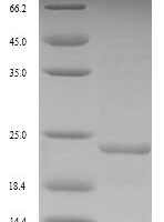 Vibrio vulnificus Fe/S biogenesis protein NfuA (nfuA) Recombinant Protein, N-His - BioCrest Sci