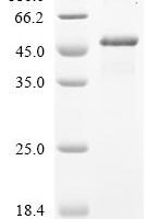 Human Fibronectin (FN1), partial Recombinant Protein - BioCrest Sci