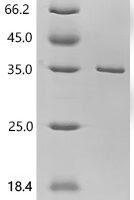Human Apoptosis-enhancing nuclease (AEN), partial Recombinant Protein, C-His - BioCrest Sci